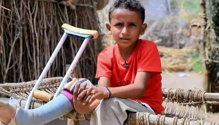 «ألغام الحوثي» تنفجر في أطفال اليمن.. 1200 قتيل ومصاب منذ الهدنة الأممية «ألغام الحوثي» تنفجر في أطفال اليمن.. 1200 قتيل ومصاب منذ الهدنة الأممية