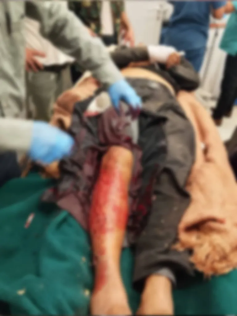 قناص حوثي يقتل مسنًا في تعز ضمن سلسلة جرائم متواصلة بحق المدنيين قناص حوثي يقتل مسنًا في تعز ضمن سلسلة جرائم متواصلة بحق المدنيين