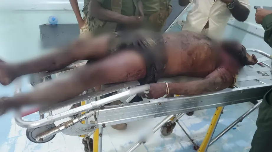 الحديدة.. مقذوف من مخلفات مليشيا الحوثي يودي بحياة مواطن في مديرية الخوخة الحديدة.. مقذوف من مخلفات مليشيا الحوثي يودي بحياة مواطن في مديرية الخوخة
