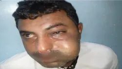 قيادي حوثي يعتدي بالضرب على محامٍ في مدينة زبيد بالحديدة